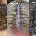 The Ordinary Multi-Peptide Serum for Hair Density Hair Styling Products 1.9oz 60ml